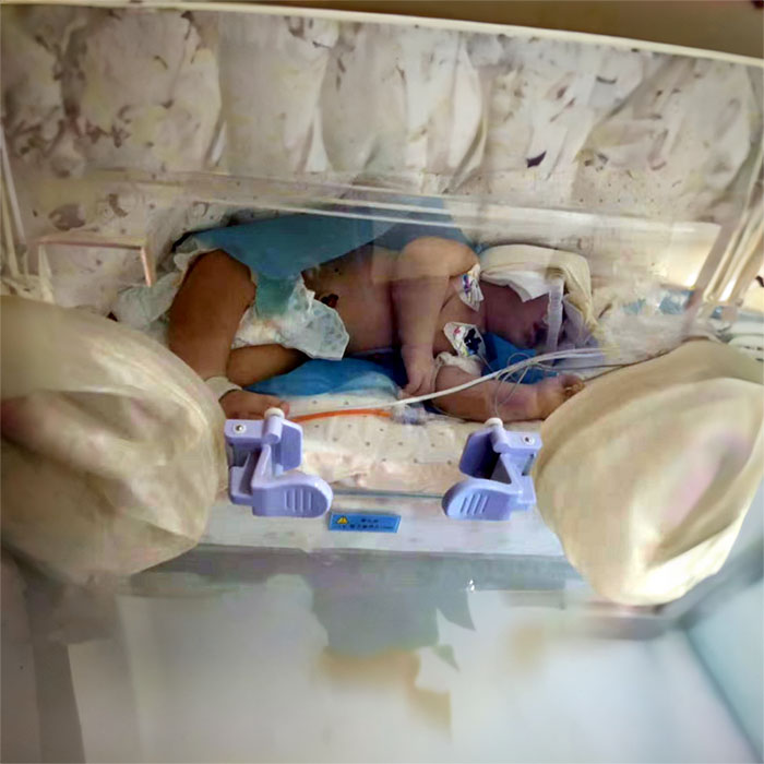 西宁急救车租赁费用